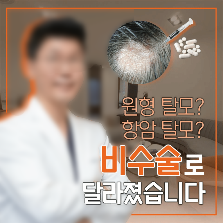 원형탈모_썸네일